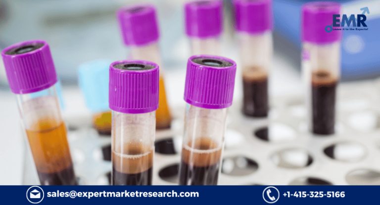 Immunodiagnostics Market Size to Grow at a CAGR of 6.10% Between 2023 and 2028