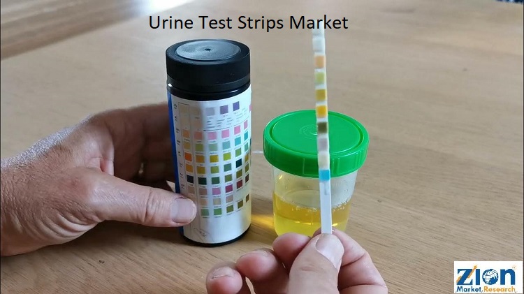 Unveiling the Future of Urine Test Strips: Innovations and Technological Breakthroughs